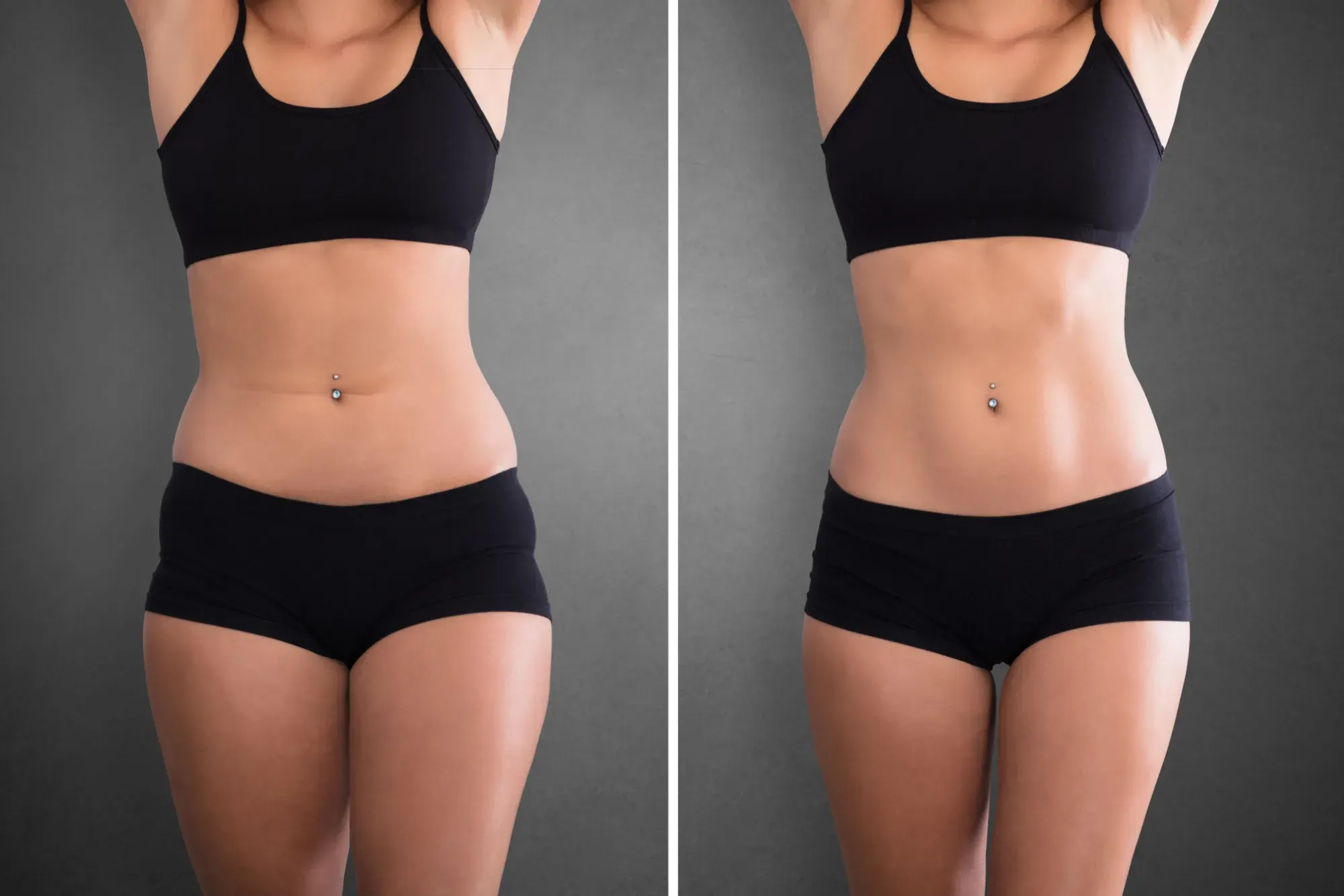 GLP-1 Weight Loss before and after