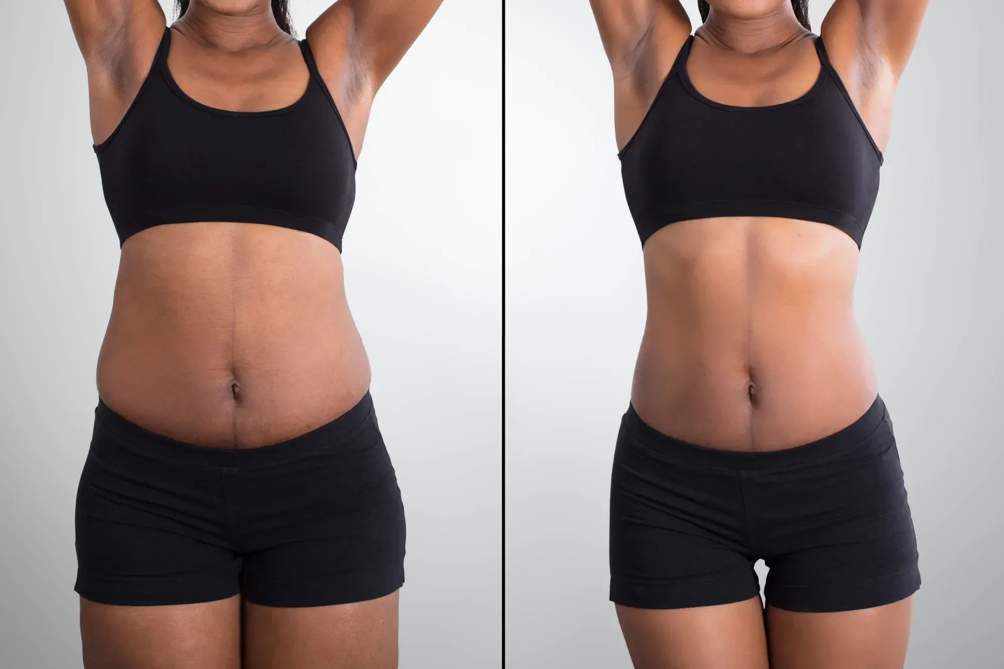 GLP-1 Weight Loss in Canton, GA before and after