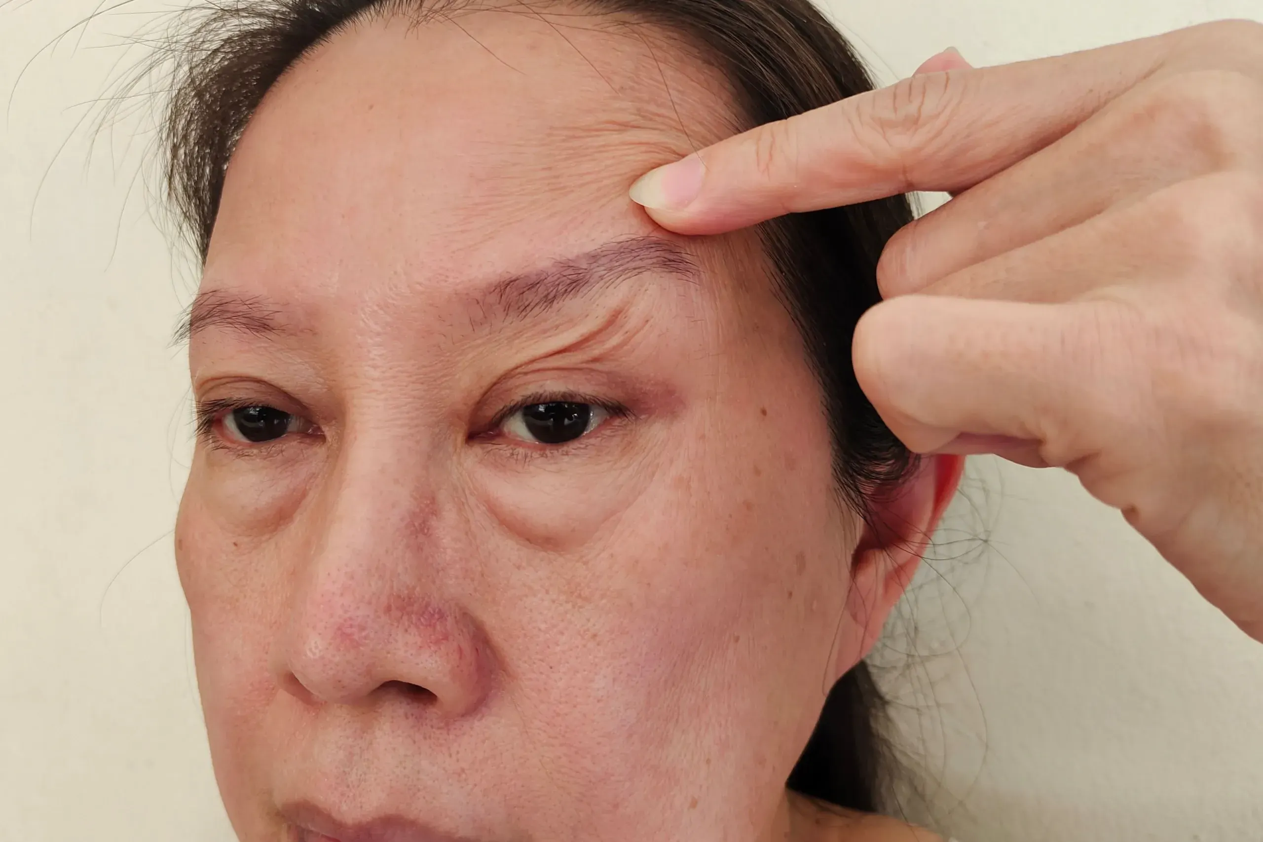Lifestyle factors contributing to skin laxity at Hartley Health and Wellness Canton